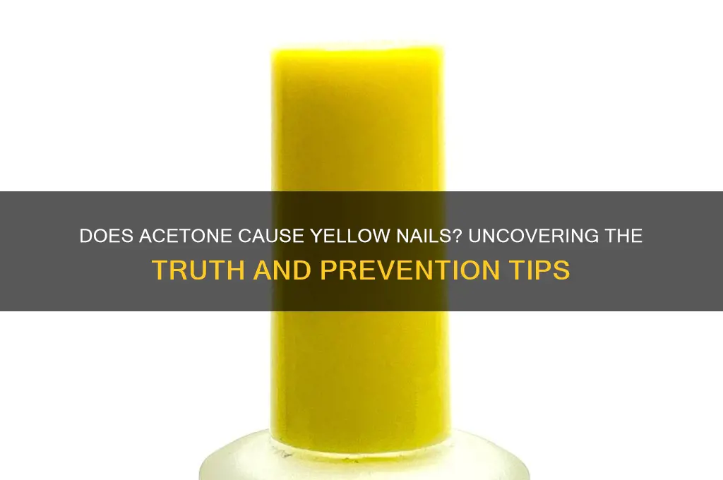 does acetone turn nails yellow