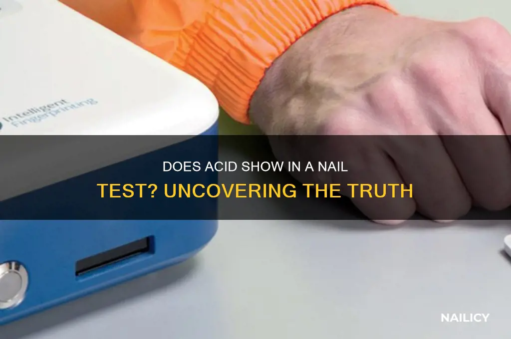 does acid show in a nail test