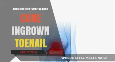 Acid Treatment for Ingrown Toenails: Effective Cure or Temporary Relief?