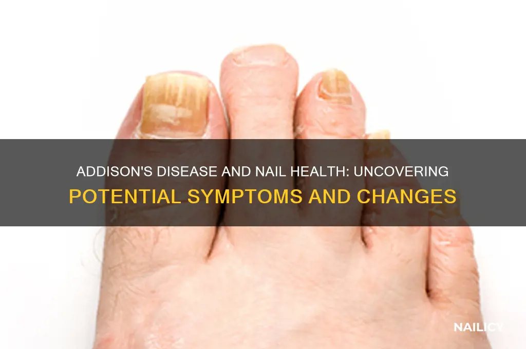 does addisons have nail involvement