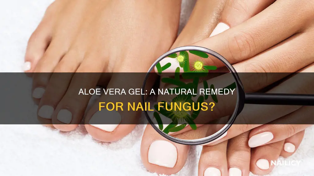 does aloe vera gel fix nail fungus