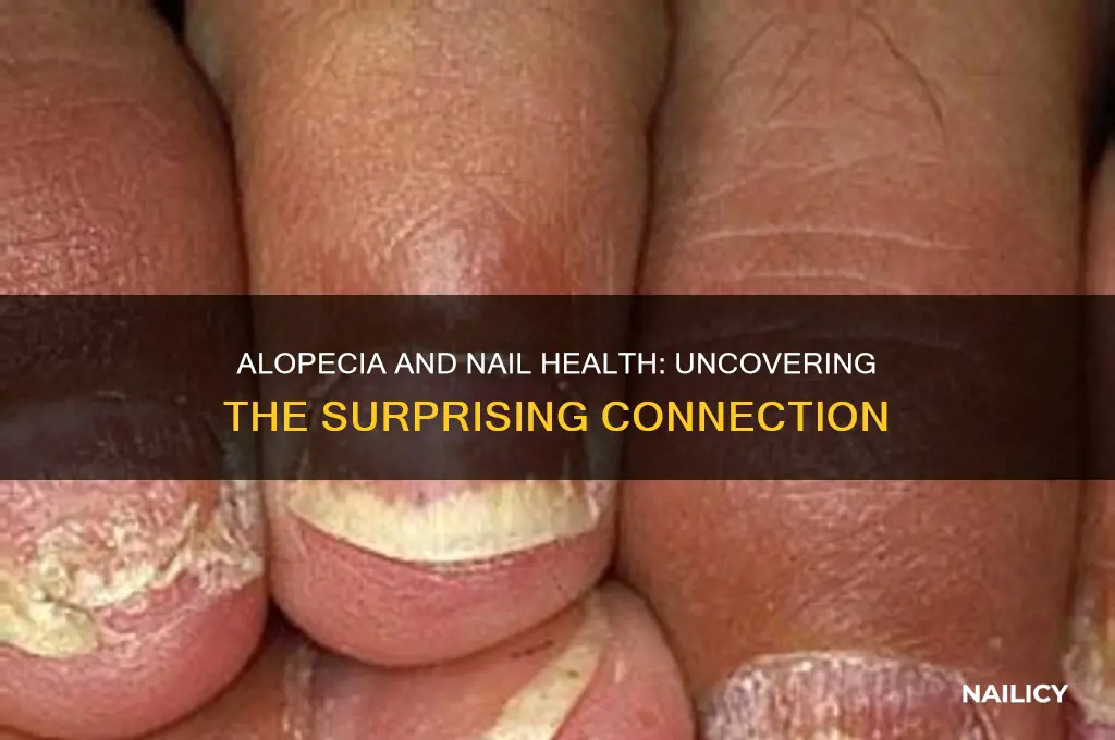 does alopecia effect nails