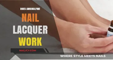 Amorolfine Nail Lacquer: Does It Effectively Treat Fungal Infections?