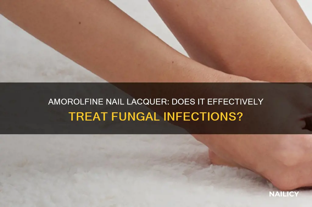 does amorolfine nail lacquer work