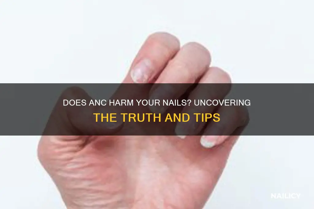 does anc damage your nails