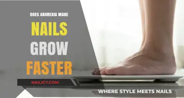 Anorexia: Faster Nail Growth Myth Explored
