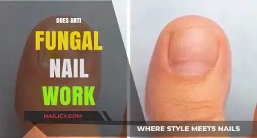 Does Antifungal Nail Treatment Really Work? A Comprehensive Review