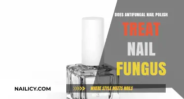 Can Antifungal Nail Polish Effectively Treat Nail Fungus? Find Out