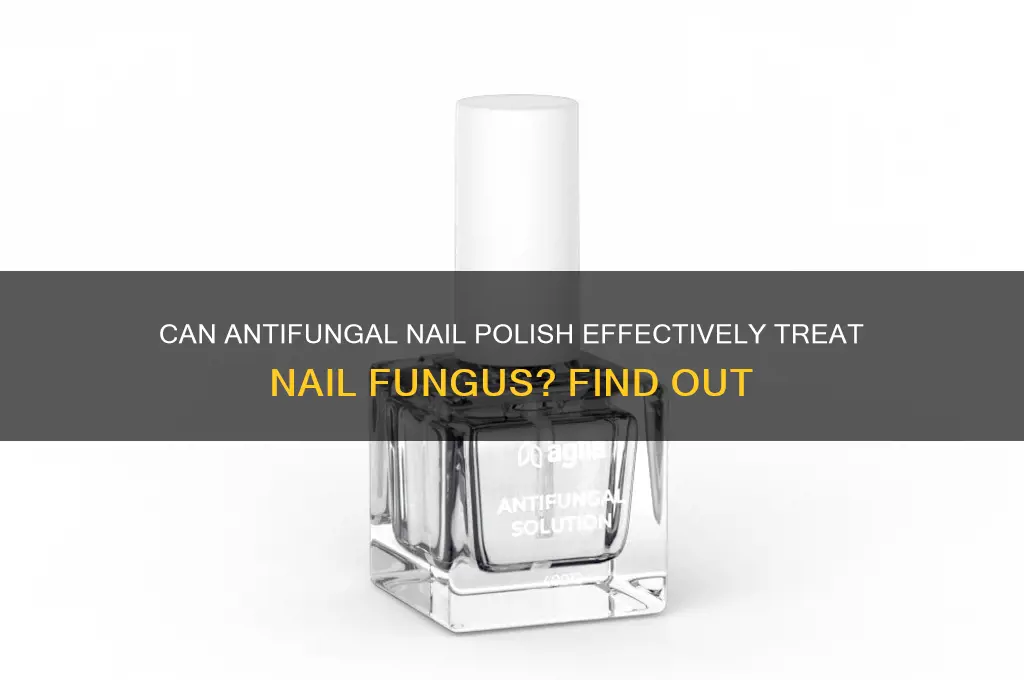 does antifungal nail polish treat nail fungus