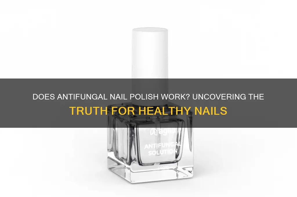does antifungal nail polish work