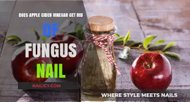 Natural Remedies: Apple Cider Vinegar's Role in Treating Fungal Nail Infections
