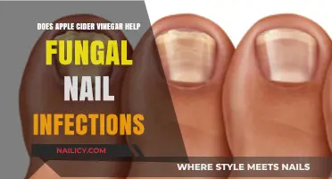 Apple Cider Vinegar for Fungal Nail Infections: Effective Remedy or Myth?