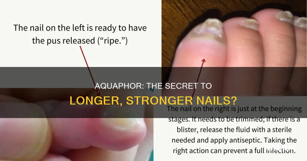 does aquaphor help nails grow