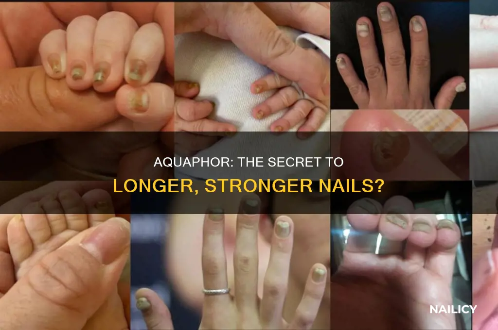 does aquaphor make your nails grow