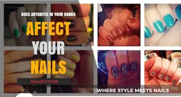 Arthritis in Hands: How It Impacts Nail Health and Appearance