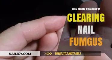 Baking Soda for Nail Fungus: Effective Remedy or Myth?