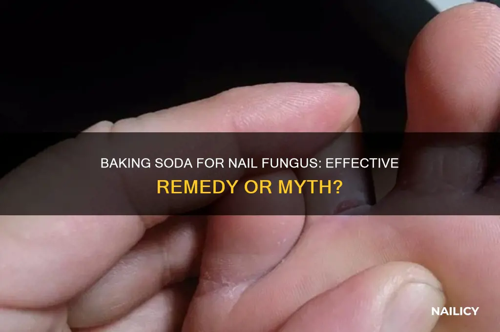 does baking soda help in clearing nail fumgus
