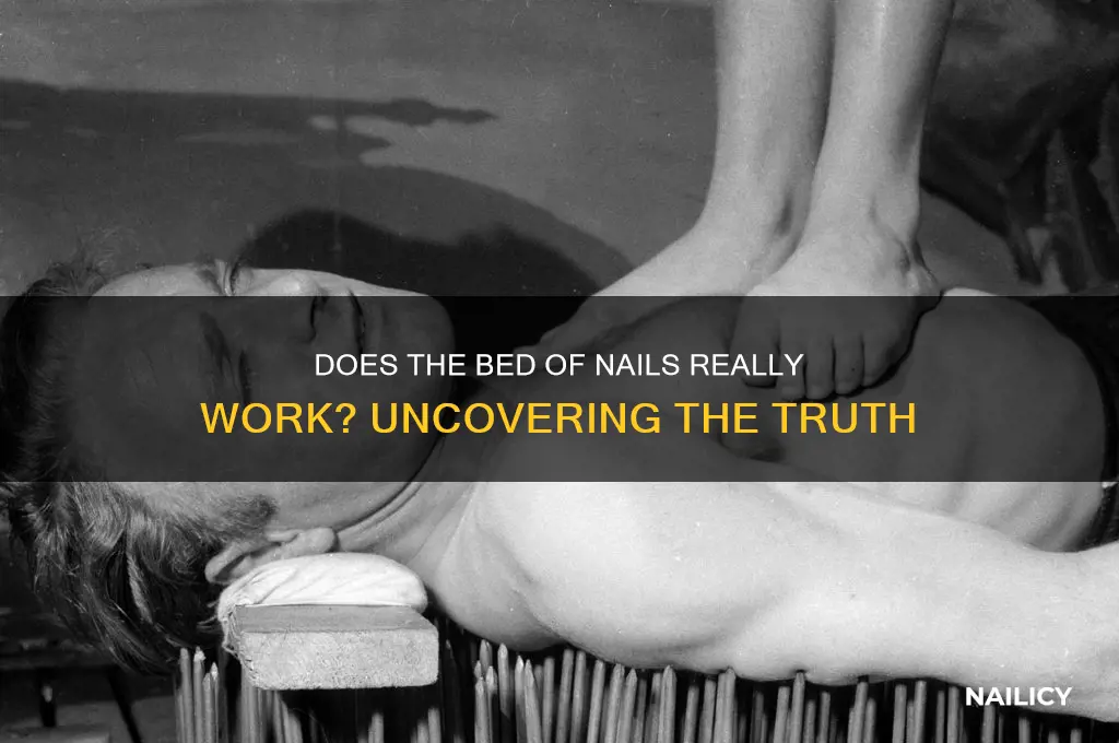 does bed of nails work
