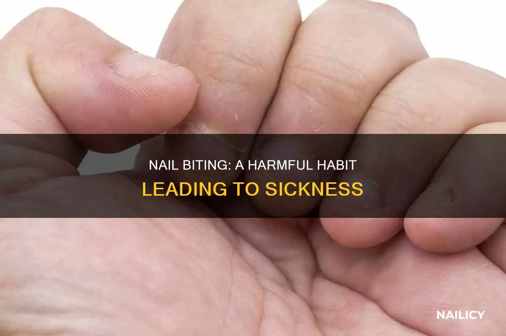 does biting nails make you sick