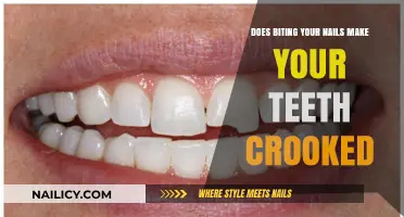 Nail Biting: Crooked Teeth and Other Dental Problems