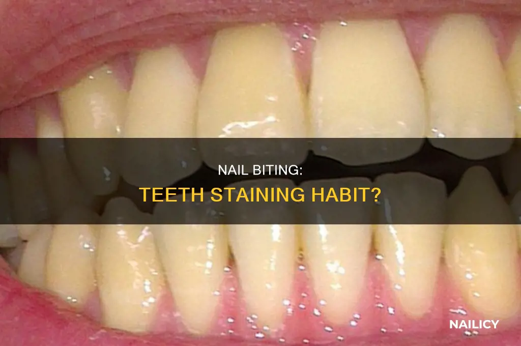 does biting your nails make your teeth yellow