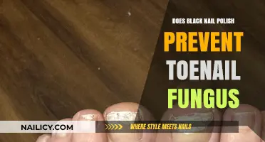Black Nail Polish: A Toenail Fungus Remedy or Myth?