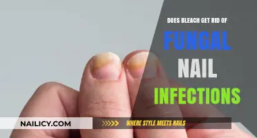 Bleach vs. Fungal Nail Infections: Does It Really Work?