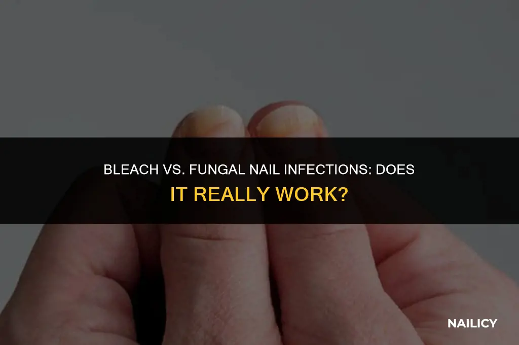 does bleach get rid of fungal nail infections
