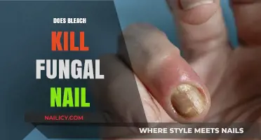 Can Bleach Effectively Treat and Kill Fungal Nail Infections?