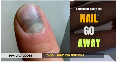 Blood Under Nail: Healing Time, Treatment, and When to Worry