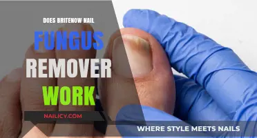 Britenow Nail Fungus Remover: Does It Work?