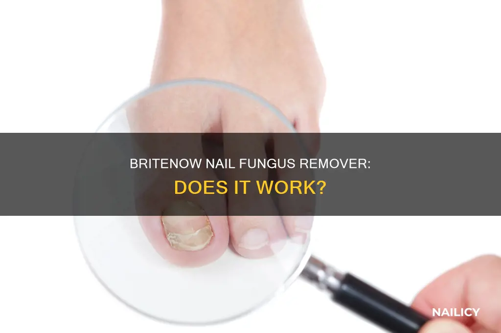 does britenow nail fungus remover work