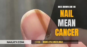 Nail Line: A Possible Cancer Indicator?