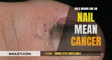 Brown Nail Lines: Cancer Warning or Myth?
