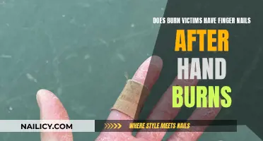 Finger Nails and Burns: What's the Connection?