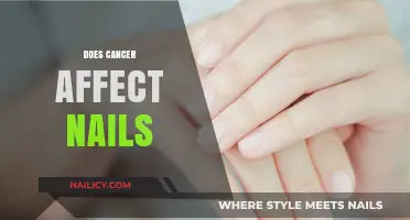 Cancer's Impact on Nails: Symptoms, Causes, and What to Watch For