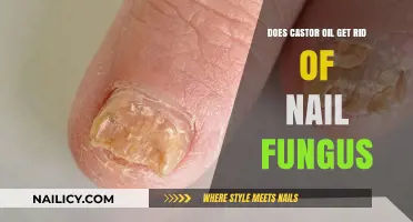Natural Remedies for Nail Fungus: The Truth About Castor Oil