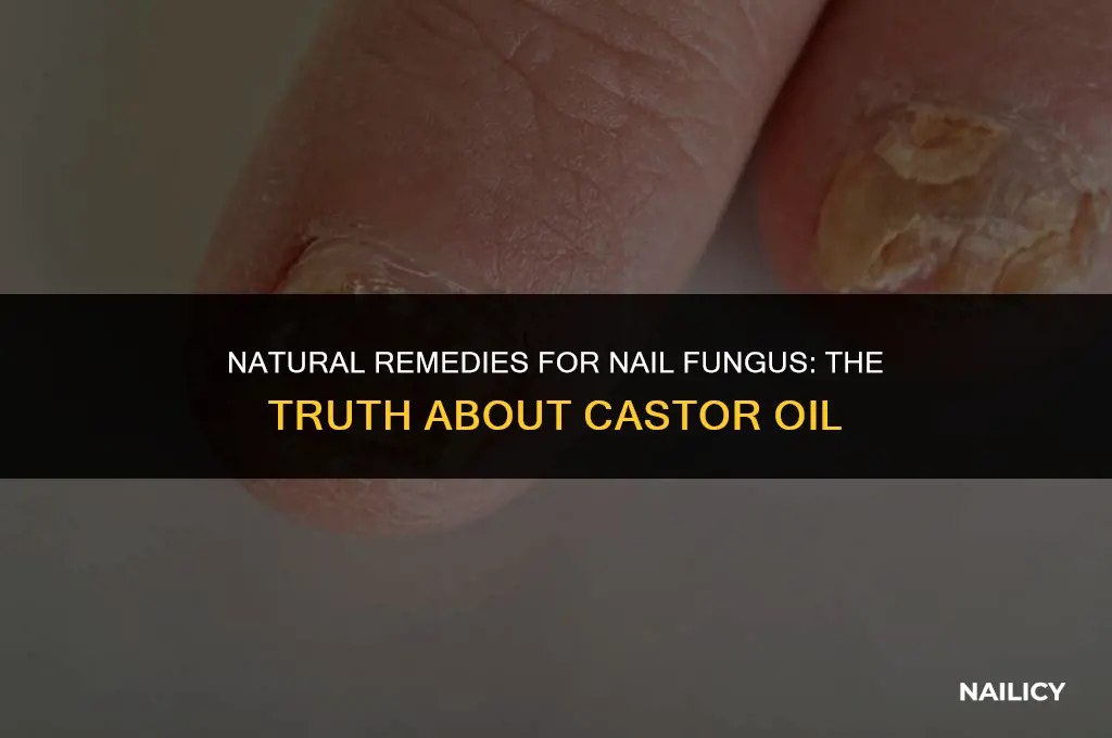 does castor oil get rid of nail fungus