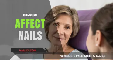 Chemotherapy's Impact: How Chemo Affects Nails and Nail Health