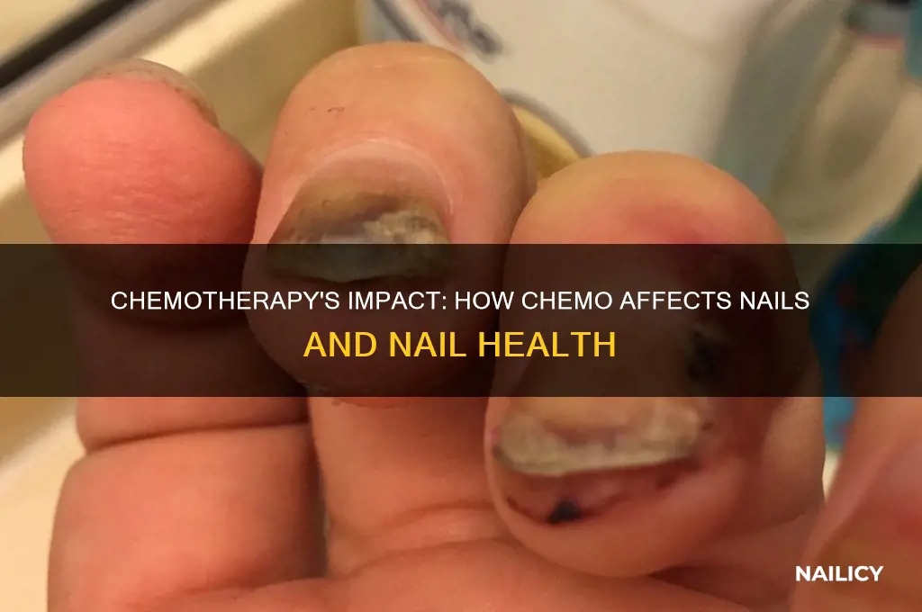 does chemo affect nails