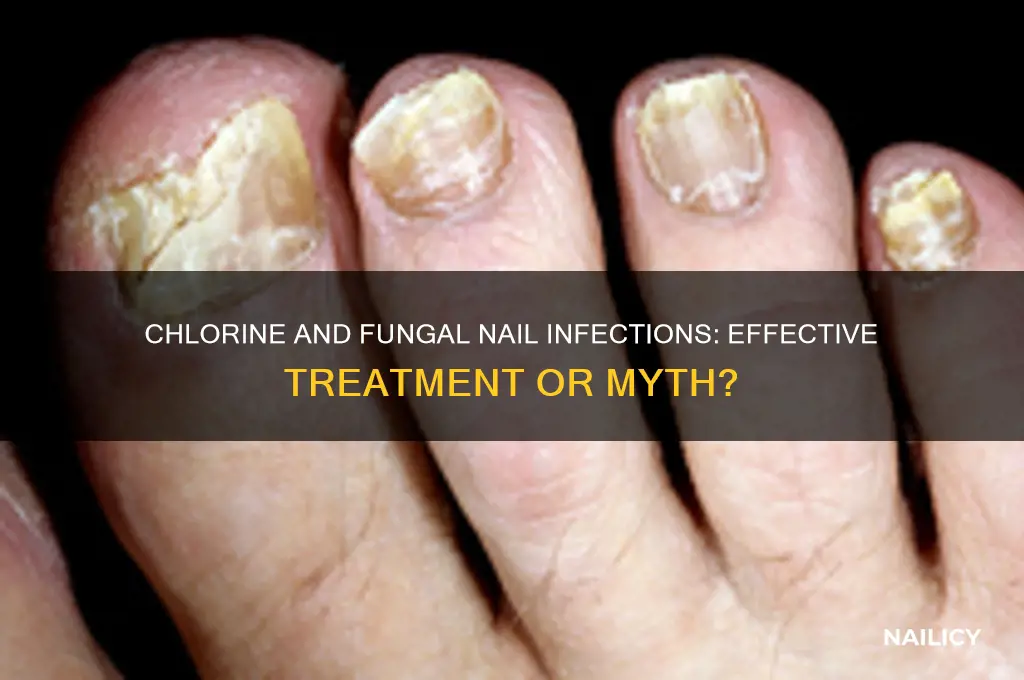 does chlorine kill fungal nail