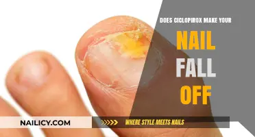 How Ciclopirox Removes Nail Fungus and Infection