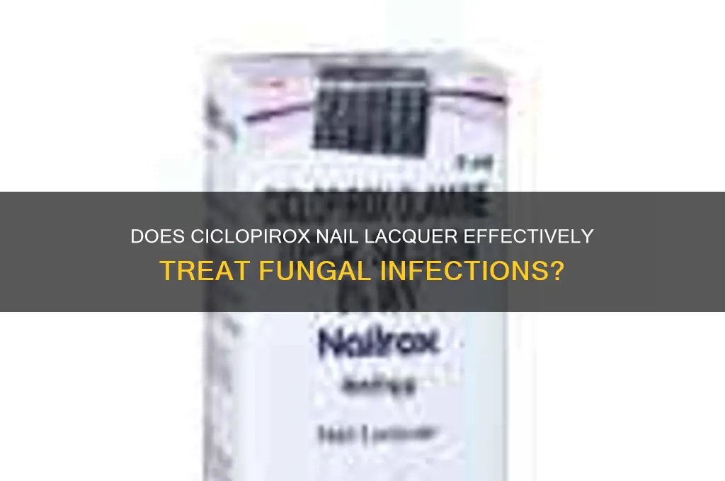 does ciclopirox nail lacquer work