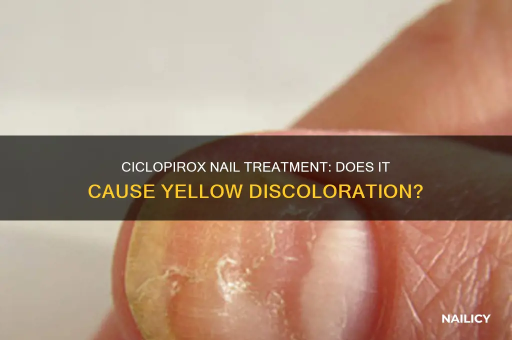 does ciclopirox turn nails yellow
