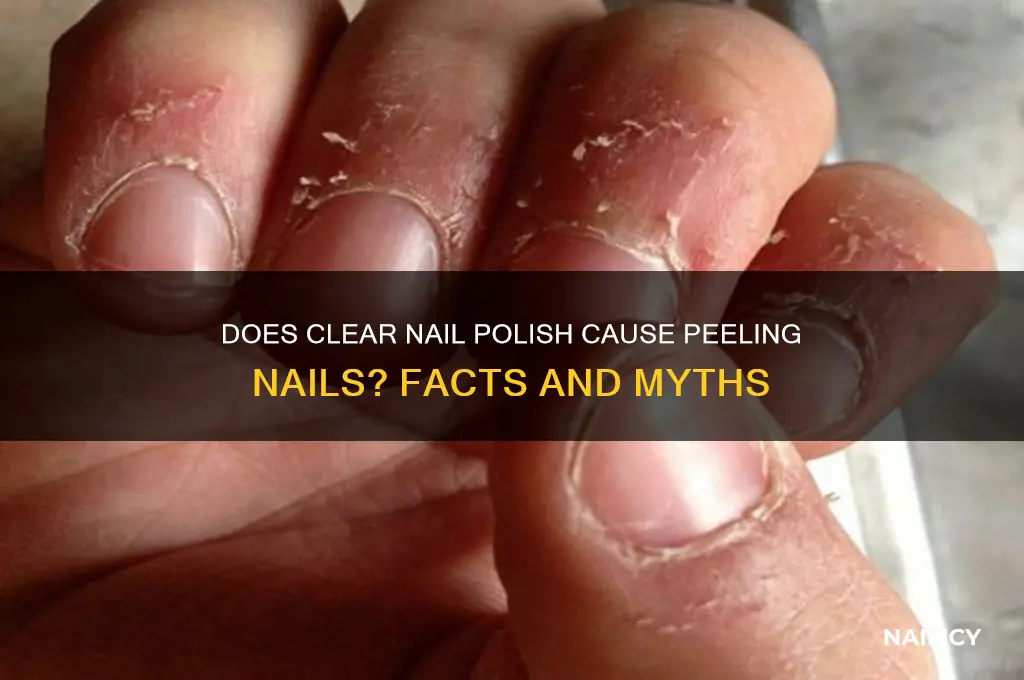 does clear nail polish cause nails to peel