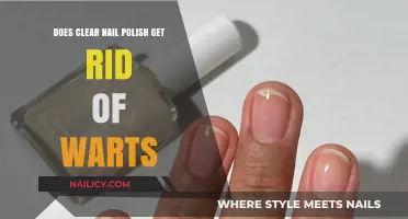 Exploring Myths: Can Clear Nail Polish Really Cure Warts?