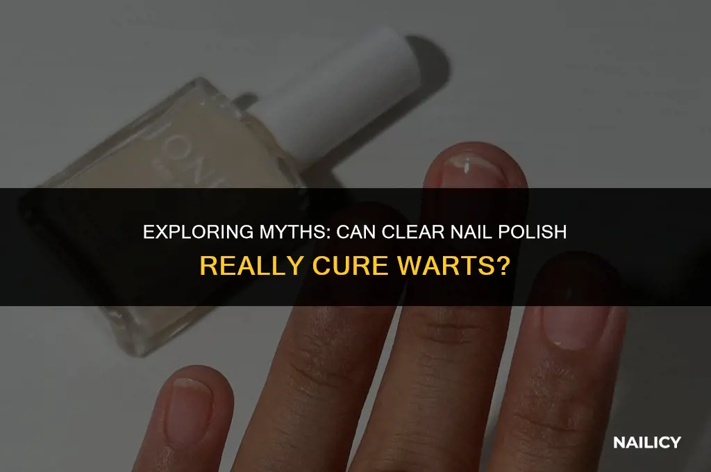 does clear nail polish get rid of warts