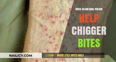 Clear Nail Polish for Chigger Bites: Effective Remedy or Myth?