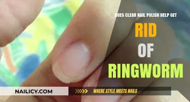 Debunking Myths: Can Clear Nail Polish Really Cure Ringworm?