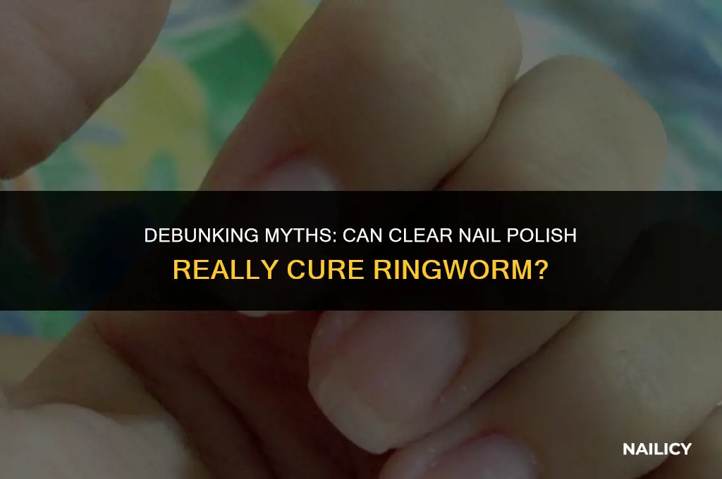 does clear nail polish help get rid of ringworm